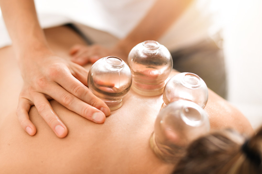 5 Surprising Benefits of Chinese Cupping