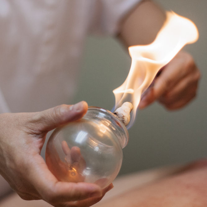 Woman,Preparing,Glass,Cup,With,Fire,For,Cupping,Therapy,,A