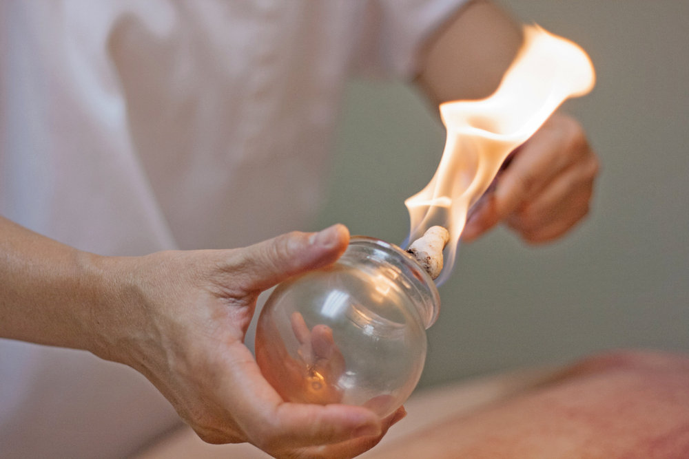 Woman,Preparing,Glass,Cup,With,Fire,For,Cupping,Therapy,,A