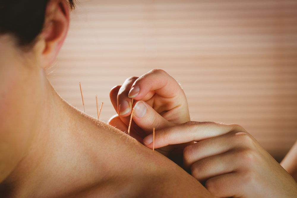 How Does Acupuncture Work?