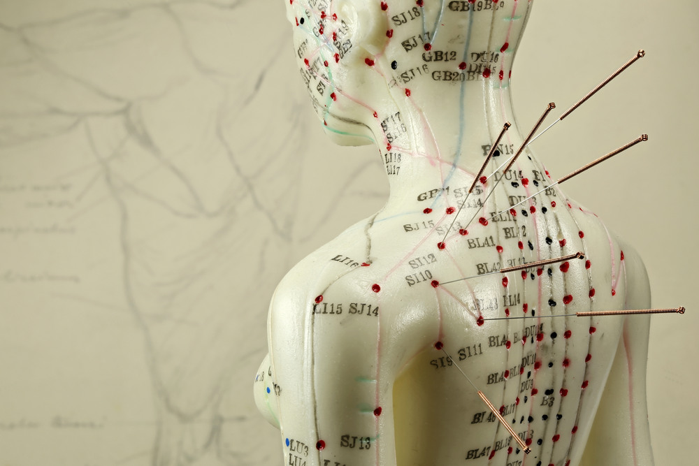 Ways Acupuncture Helps with Chronic Pain