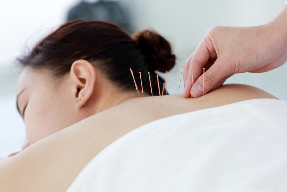 Ways Acupuncture Helps with Chronic Pain 