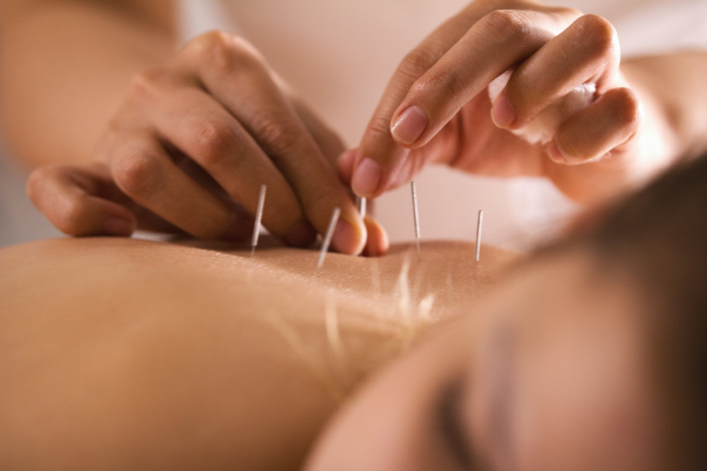 Managing Chronic Pain with Acupuncture, Cupping, and Massage