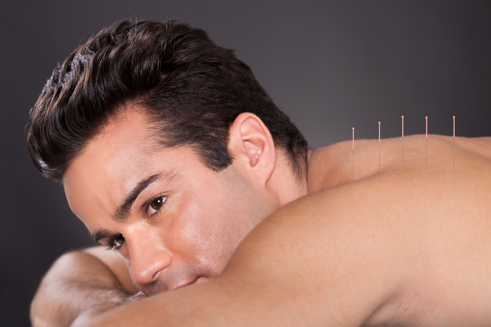 New Year, New You: The Role of Acupuncture in Achieving Wellness Goals