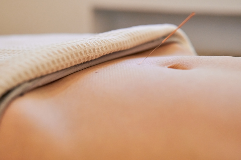 Acupuncture for Fertility: A Comprehensive Exploration
