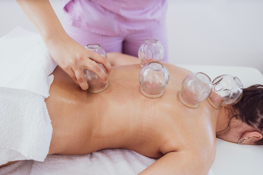 Can Cupping Therapy Improve Circulation?