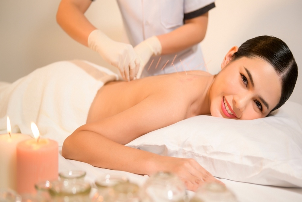 Stress Relief Through Acupuncture: Does It Work?