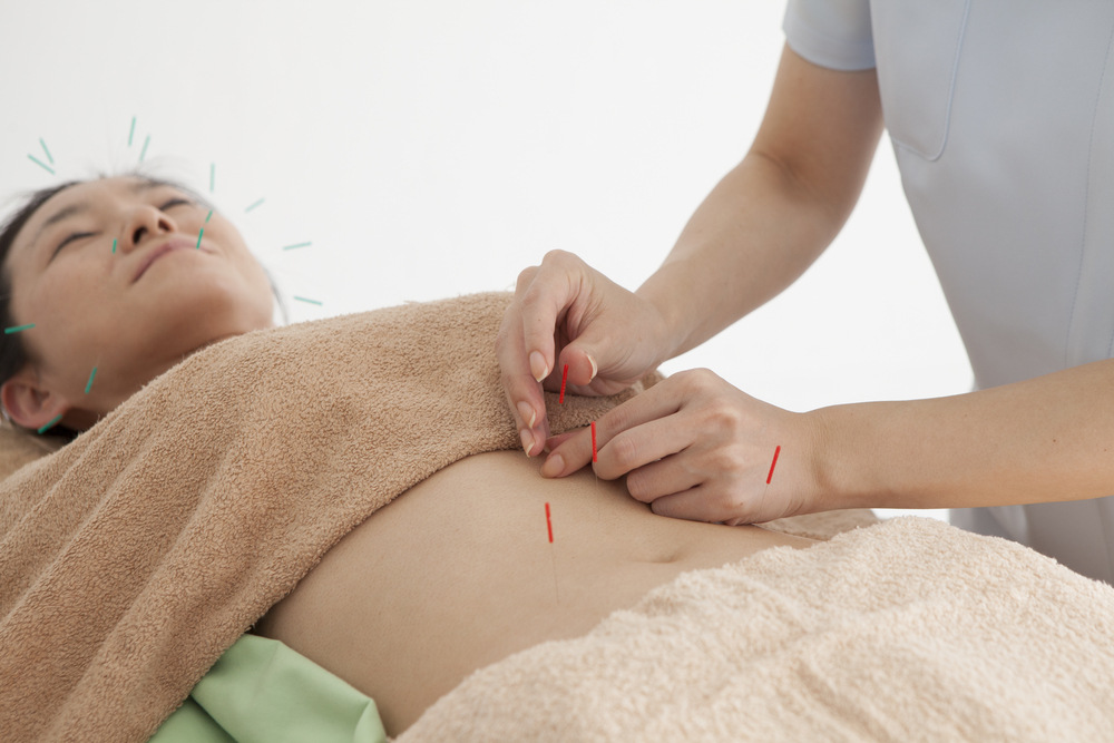 Why Acupuncture Is Effective for Digestive Health and Gut Balance