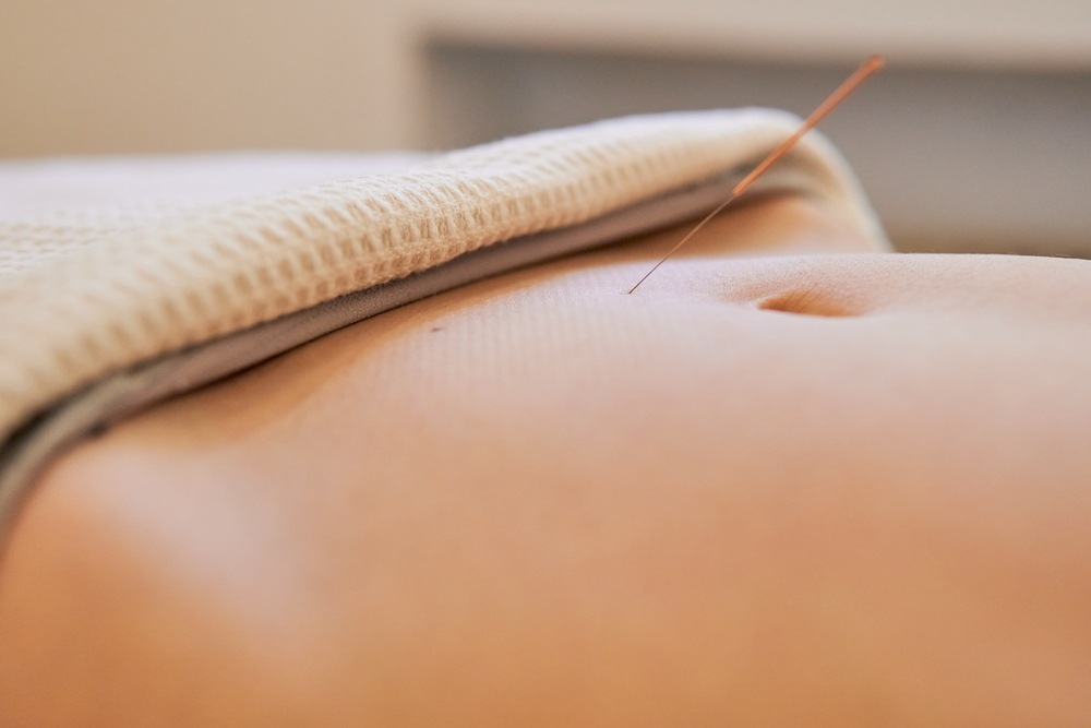When Acupuncture Is Considered for Fertility and Reproductive Wellness Support