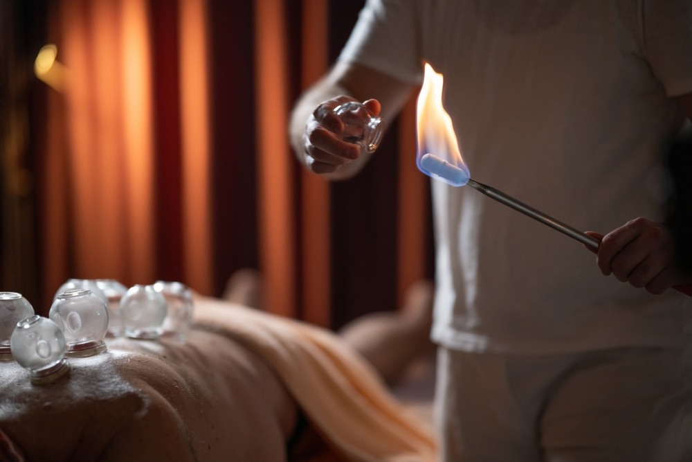 How Cupping Therapy Can Complement Your Wellness Routine